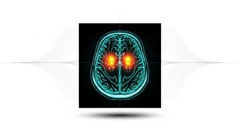 Обструктивната сънна апнея повишава риска от мозъчни микрокръвоизливи