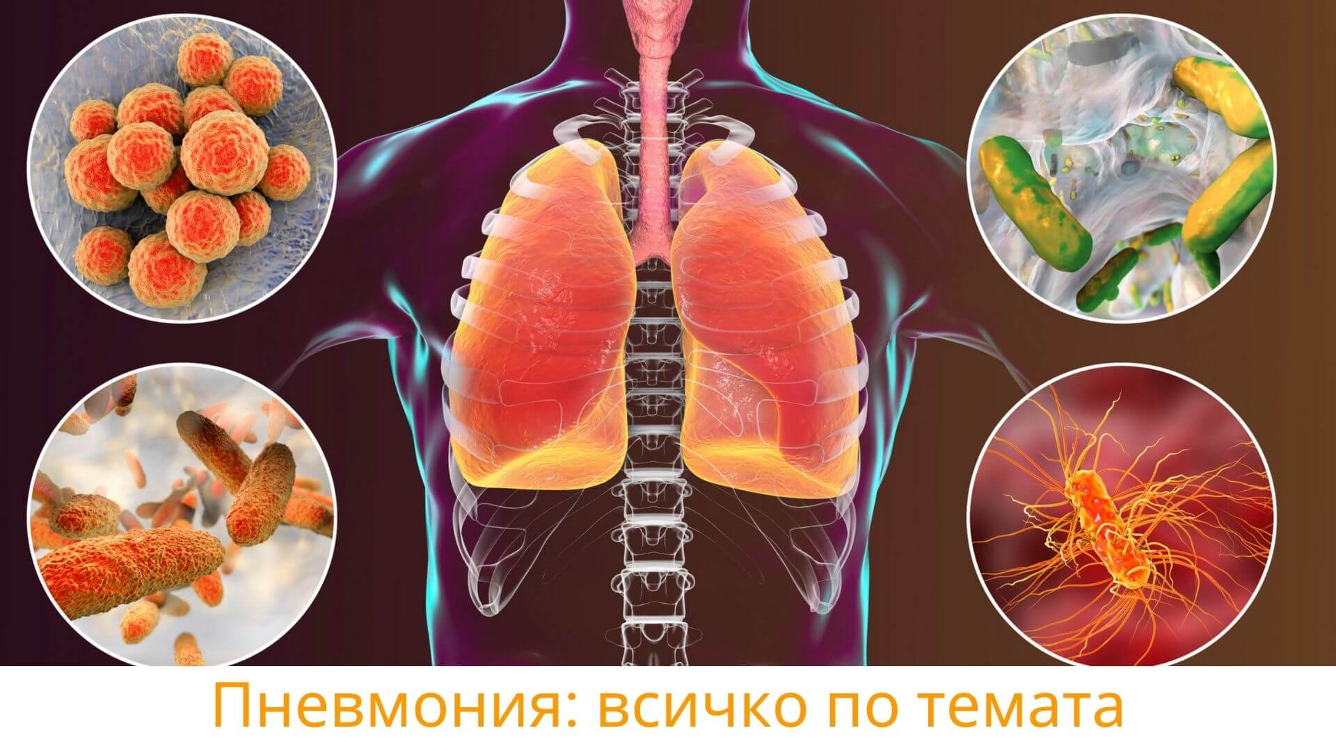 Пневмония изображение с бял дроб с различните видове пневмония